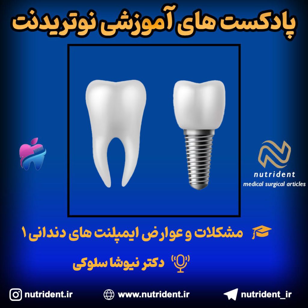 مشکلات و عوارض ایمپلنت های دندانی
